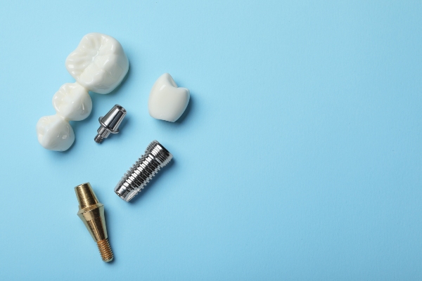 How To Choose The Right Implant Dentist For Your Needs