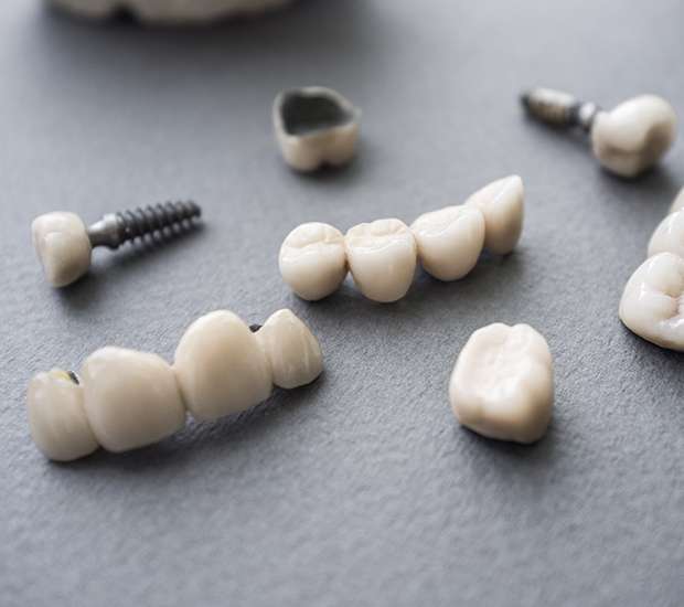 Highland The Difference Between Dental Implants and Mini Dental Implants