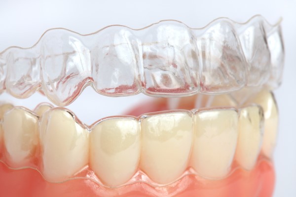 Tips For Finding A Good Invisalign Dentist