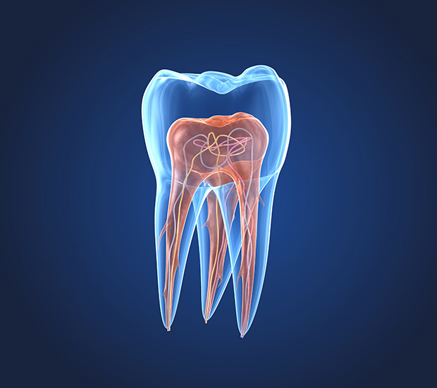 What is an Endodontist Highland, UT Lush Dental Co. Issues an