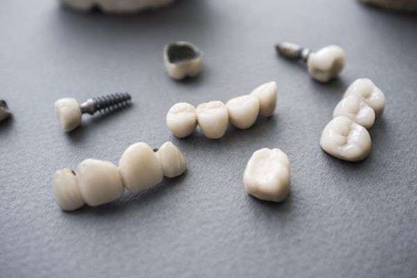 Types of Dental Implants from Lush Dental Co. in Highland, UT